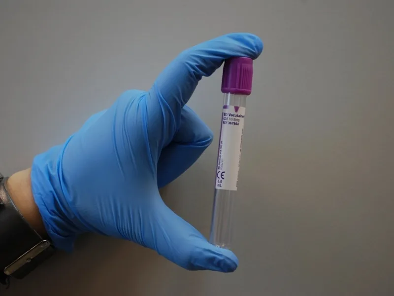 Tubo de laboratorio para la prueba de antígeno prostático